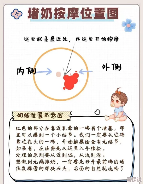 医生用力揉搓着乳腺，揭示健康隐患与女性自我检查的重要性，助你更好地关注身体变化