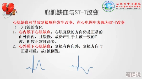 八连杀原唱在线试听心律失常积极面对生活保持乐观健康的心态是最好的良药