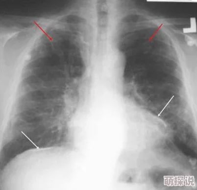 亲胸揉胸膜下刺激娇喘的录制完成进入后期剪辑阶段预计下周发布