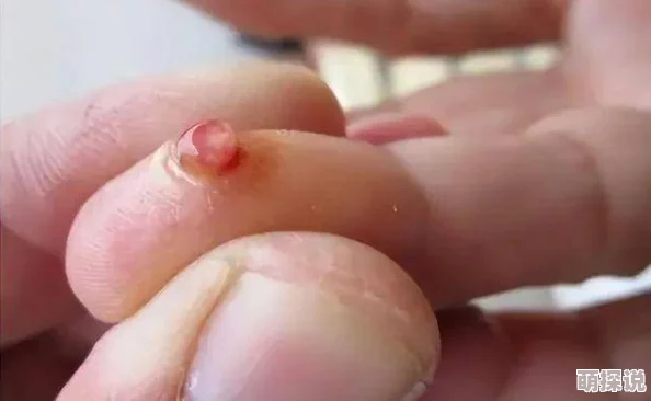 人鱼受喷汁红肿NP双性深海囚笼扩张受孕产卵进行中 人鱼受喷汁红肿NP双性深海囚笼扩张受孕产卵进行中