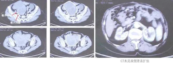 人鱼受喷汁红肿NP双性深海囚笼扩张受孕产卵进行中 人鱼受喷汁红肿NP双性深海囚笼扩张受孕产卵进行中