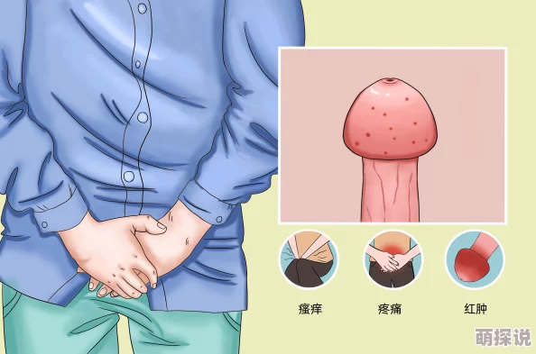 龟头上长了像痱子一样的据说是单身久了内分泌失调惹的祸