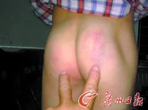 打屁股打到嫩红视频网站传播此类内容违法且有害身心健康请勿观看