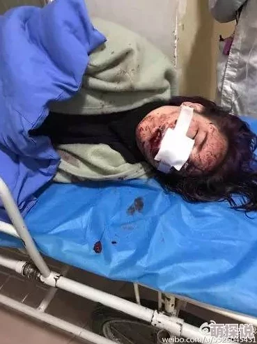 我脱了护士的湿润三角裤视频疯传已报警警方介入调查