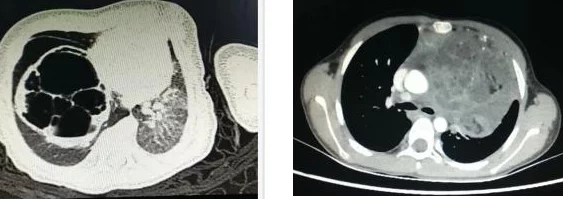 男人边摸边吃奶边做下面这种行为是对女性的极大不尊重和伤害，可能构成性侵犯