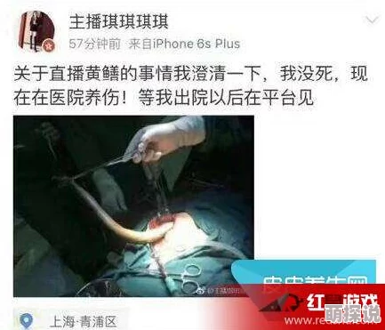 李毅吧大尺度深夜福利涉嫌传播淫秽色情信息已被举报至相关部门